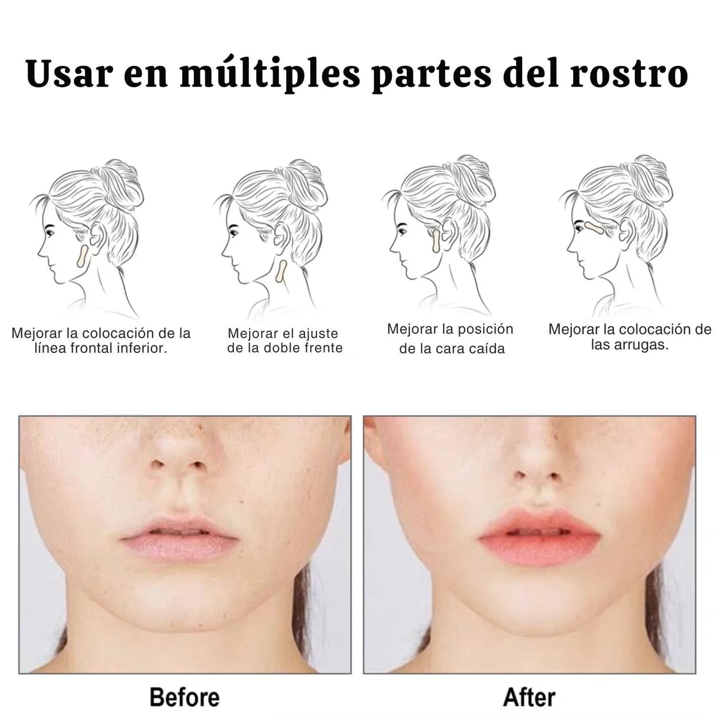 PACK 80 PARCHES LIFTING FACIAL PARA ARRUGAS, PAPADA